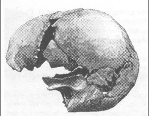 castenedolo skull